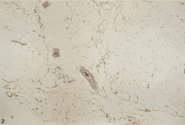 A close up of the surface of a marble slab