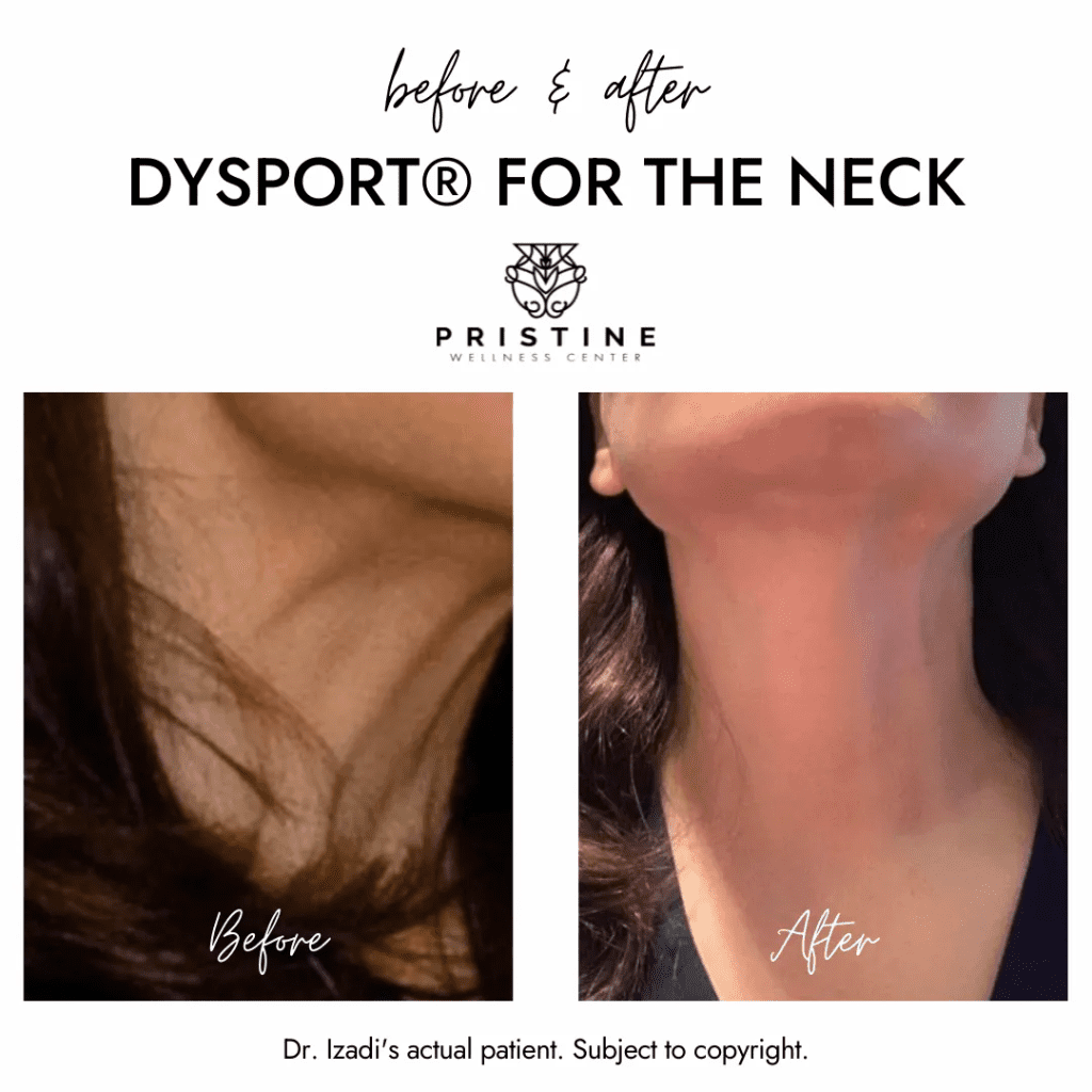 A before and after picture of the neck of a woman.