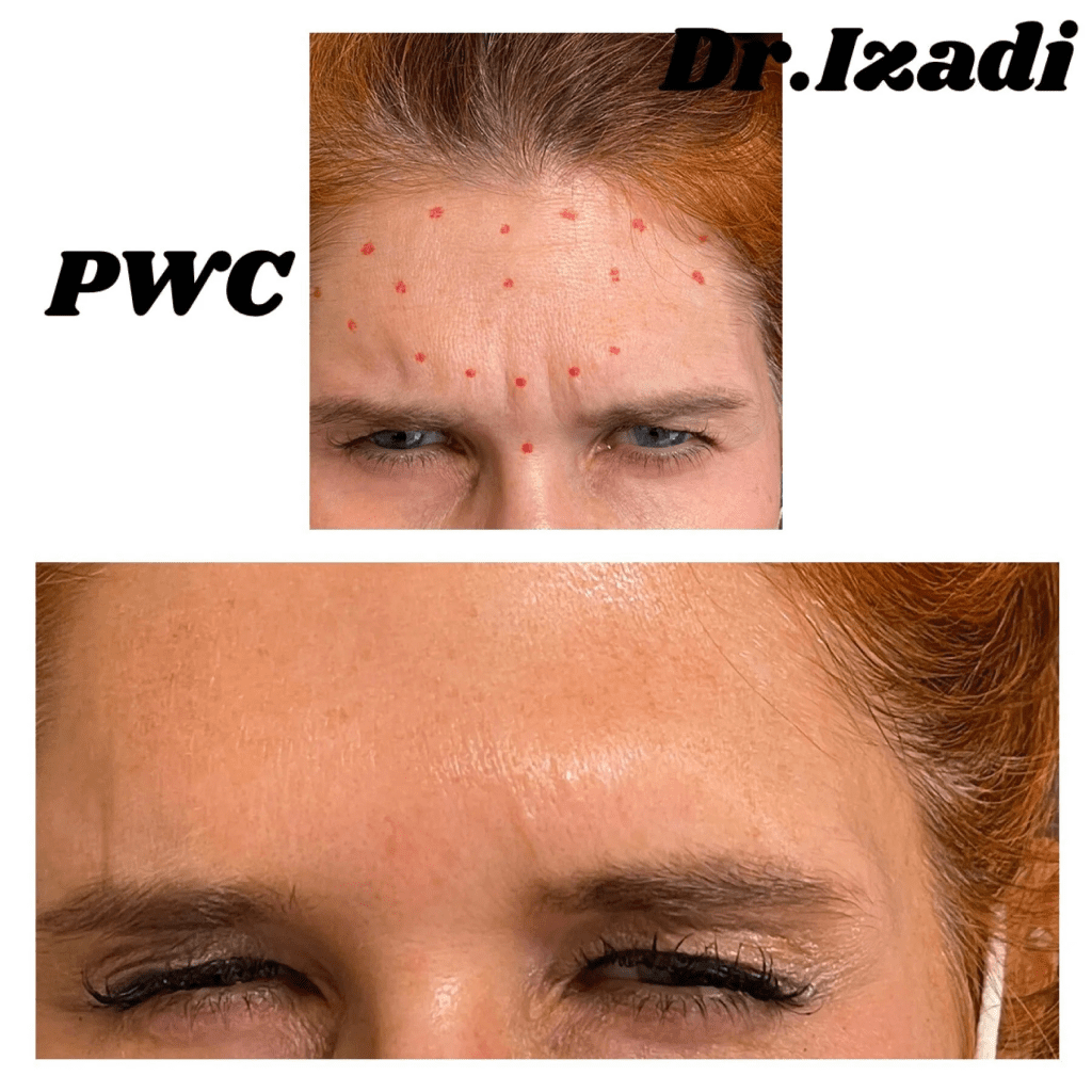 A woman with red spots on her forehead and the face of another person.