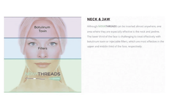 A picture of the face and neck with different types of thread.