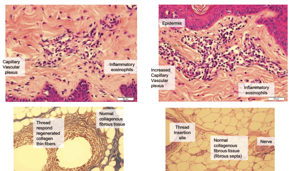 A series of pictures showing different types of tissue.