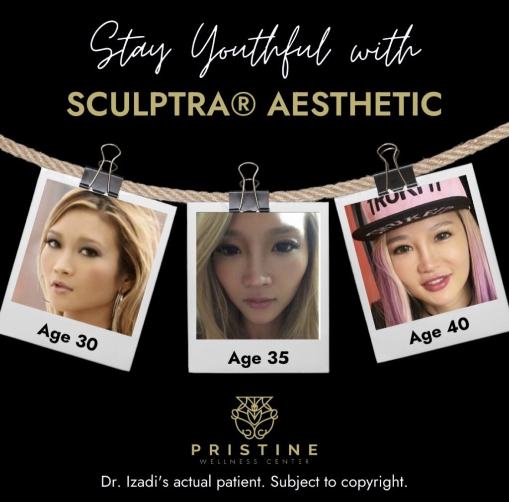 A poster with three photos of women and the text " stay youthful with sculptra ® aesthetic ".